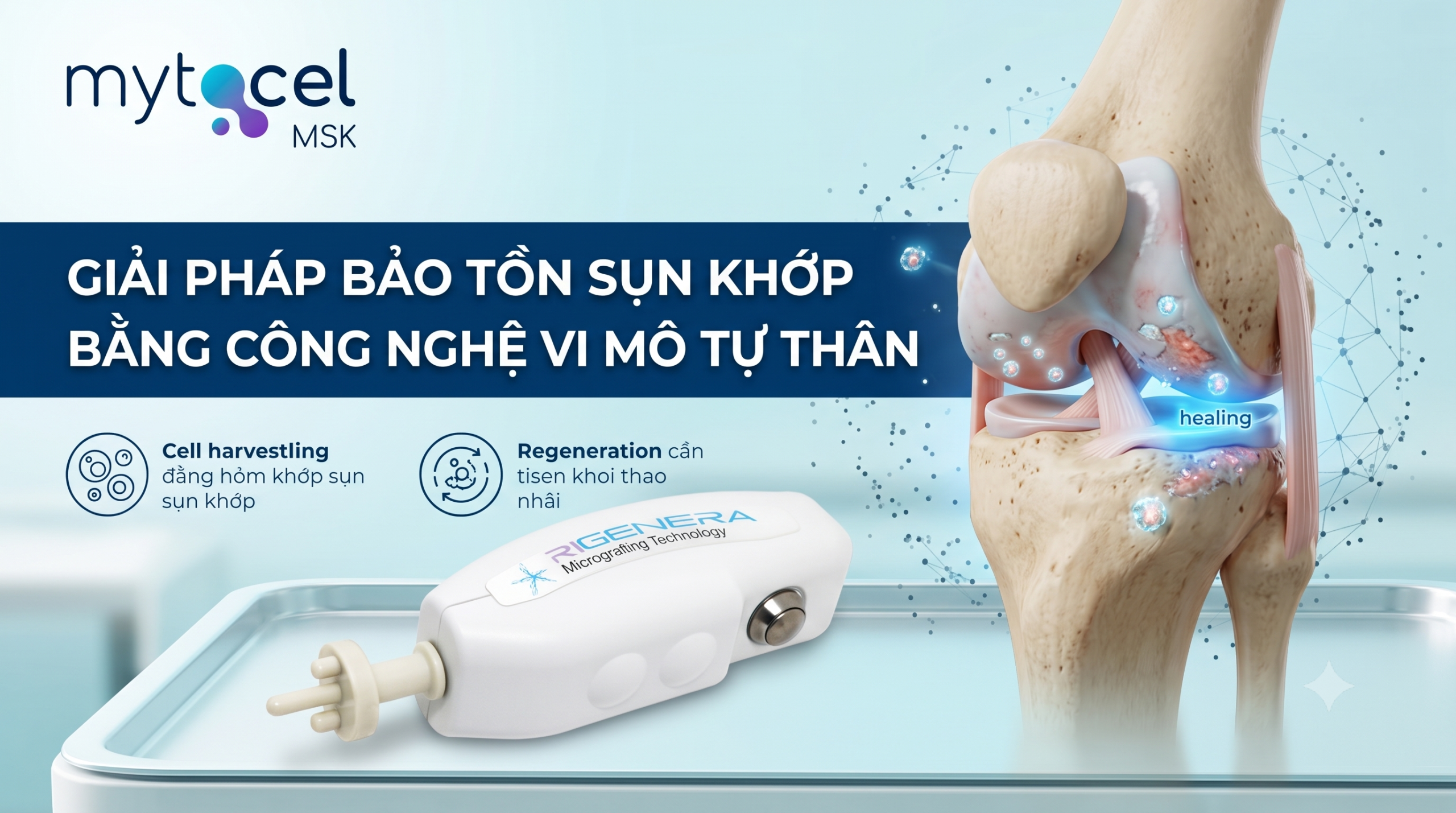 Ai Nên Cân Nhắc Bảo Tồn Khớp Sớm? 5 Dấu Hiệu Vàng Cho Thấy Đã Đến Lúc Cần Hành Động